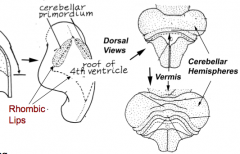 - Dorsal outgrowths of metencephalon, called the Rhombic Lips (part of Alar plate)
- Thombic lips fuse at midline to form Cerebellar Pate (fusion area = Vermis)
- Hemisphere expands laterally on each side of vermis