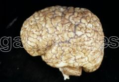 - Excessive sulcation of cortex
- Smaller than normal gyri
- Only four layers in cortex due to insufficient neuroblast migration
- Severe developmental delay
- Speech problems
- Seizures
- Hypotonia