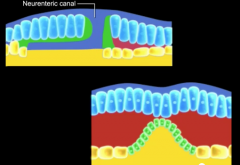 Neurenteric canal - between amniotic cavity and secondary UV (yolk sac)