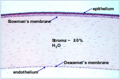 - Epithelium
- Bowman's membrane
- Stroma
- Descemet's membrane
- Endothelium