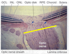 Network of collagen fibers through which the fibers of the optic nerve exit the eye - may be altered in glaucoma