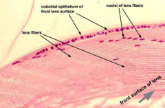 - Capsule - ECM surrounding lens
- Epithelium - anterior surface of lens
- Lens fibers - body of lens (no organelles)