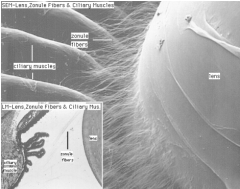 Fibers (suspensory ligaments or zonules) attached to ciliary body