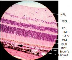Ganglion Cell layer - nuclei of ganglion cells