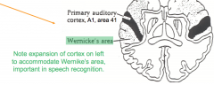 - Expansion of cortex on L to accommodate Wernicke's area
- R side does not show this same expansion
(found in temporal lobes)