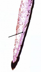Sphincter pupillae muscle
