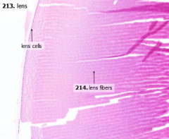 A = Lens cells
B = Lens fibers