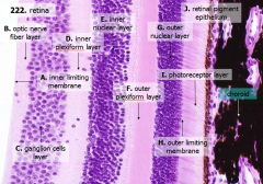 J - Retinal pigment epithelium
I - Photoreceptor layer
H - Outer limiting membrane
G - Outer nuclear layer
F - Outer plexiform layer
E - Inner nuclear layer
D - Inner plexiform layer
C - Ganglion cell layer
B - Optic nerve fiber layer
A - Inner l