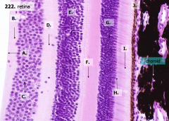 What layers of the retina include the photoreceptors (rods and cones)?