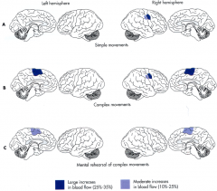 Increased blood flow to right hemisphere (opposite side) in primary motor cortex