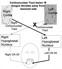 Tongue deviates away from lesioned side (but points to CN XII that is not receiving input)