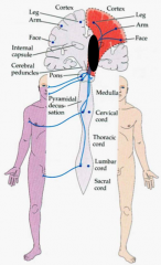 * L posterior limb of internal capsule
- L LCST/corticobulbar at internal capsule or L pons
- Stroke or MS

- No cortical signs & leg involved (so has to be 2 vascular territories)
- No spinal level --> not cord
- R pure motor problem with UMN signs