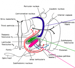 - Located between the hypothalamus and dorsal thalamus
- Zona incerta - rostral continuation of reticular formation of brainstem (GREEN)
- Subthalamic Nucleus - part of basal ganglia (PINK)