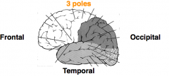 - Frontal
- Temporal
- Occipital