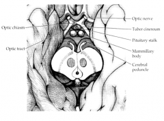 "Gray Protuberance" - bulge located between the optic chiasm and mammillary bodies