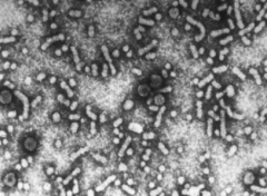 The heterogenous appearance of this virus (multiple shapes of particles including long filamentous and round) indicates what virus?