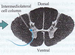 Cell bodies in the Intermediolateral cell column (IML) in the thoracic cord (pre-ganglionic cells)
