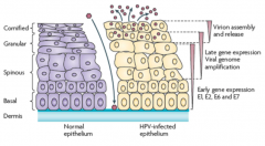 Differentiation state of the keratinocytes