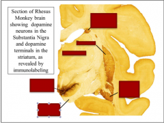 Identify head of caudate nucleus, putamen, thalamus, tail of caudate, substantia nigra, cerebral peduncle