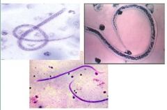 

c)       Quais as técnicas laboratoriais para identificação do parasito? 