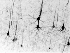 The cortical neurons that project to the striatum are the layer __ pyramidal neurons. Many of the neurons in layer __ that project to striatum also send motor commands

to the spinal cord and pre-motor neurons of the hindbrain. This is what these...