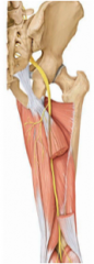 L4- S3


- very wide nerve (thumb width)


--> functionallay two nerves stuck together


- posterior aspect of the pelvis


- sits right below the PIIS


- associated with the piriformis


--> innervates the posterior compartment of the thigh ther...