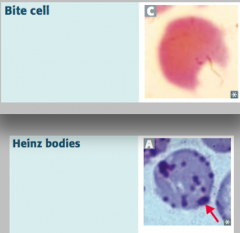 Heinz bodies:
- Oxidized hemoglobin precipitated within RBCs

Bite cells:
- Results from phagocytic removal of Heinz bodies by splenic macrophages

*Think, "Bite into some Heinz ketchup"*