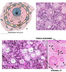 primary oocyte surrounded by single layer of follicular cells
simple squamous epithelium
resting in prophase of meiosis I
about 20 start maturing with each menstrual cycle, only one succeeds from either ovary, others become atretic
