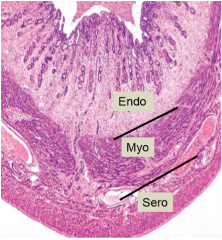 endometrium (tunica mucosa): simple columnar epithelium (stratum functionale-- shed, stratum basale-- retained)
myometrium (tunica muscularis): smooth muscle
serosa (tunica serosa or perimetrium)