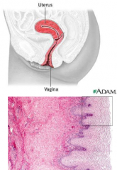 elastic, muscular canal with soft, flexible lining for lubrication and sensation
connects uterus to world
vulva and labia form entrance
cervix protrudes in
receives penis and expels menstrual flow
birth canal
no glands but bacteria produce lactic ...