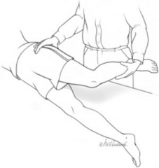 iliotibial band which limits adduction of the hip while in an extended position.