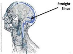 Straight sinus