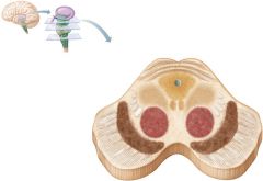 Locate the LCST, Cerebral aqueduct, and substantia nigra in the midbrain