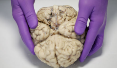 Før i tiden kunne man kan undersøge den døde, passive hjerne. nu kan man undersøge hjernen mens den er aktiv, blandt andet igennem PET og fMRI. Dog har muligheden for at måle hjerneaktivitet på en bestemt måde gjort, at man også stiller un...