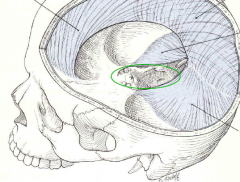 Name the dural folds and the green encircled area.