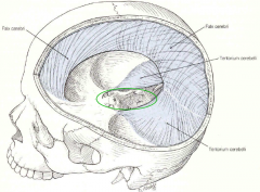 area between the tentorium cerebelli = tentorial notch