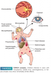 Embryos or fetuses infected in utero with 
TOxoplasma,
Rubella, 
Cytomegalovirus, or
Herpes simplex virus 
exhibit similar developmental defects (TORCH complex)