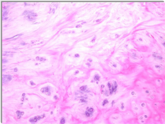 based on histology image what is the Dx & def?
tx
describe histo

 