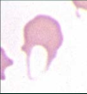 1. What spiculated RBC shape is this?
2. The fragments of the RBC released are called?