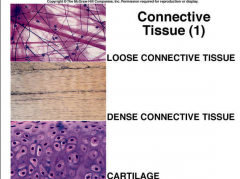 - Loose connective tissue consists mostly of loosely packed fibers in its matrix