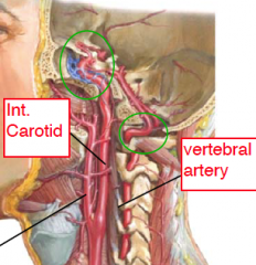 1. Internal carotid arteries


2. Vertebral arteries