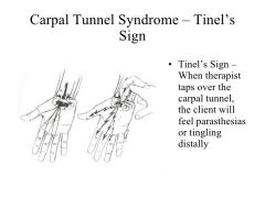 detects irritated nerves

lightly tap over nerve

+ test = pins and needles sensation

can indicate radial tunnel syndrome, Guyon's canal, syndrome, pronator teres syndrome, CTS