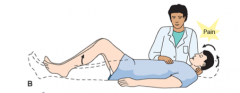 involuntary flexing of knees and hips after passive flexing of the neck while supine

meningitis