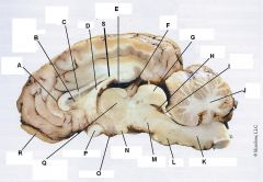 C. Connects right and left hemispheres of cerebrum.