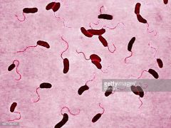 gram negative, flagellated, comma shaped , axidase positive

grows in alkaline media 

endemic in developing countries

produces rice-water diarrhea via enterotoxin that permanently activates Gs --> cAMP

sensitve to stomach acid

transmitted by ...