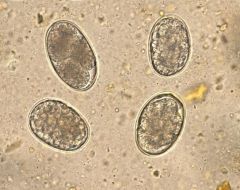 Dipylidium


Toxocara


Ancylostoma


Isospora