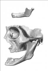 La 3e branche du trijumeau, c'est-à-dire le nerf mandibulaire. Lorsque la mandibule est usée, par exemple à cause d'un dentier, on voit les foramens mentonniers à l'intérieur.