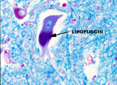 Lipofuscin granules are lipid-filled waste products that can collect around neurons (as well as other cell types).