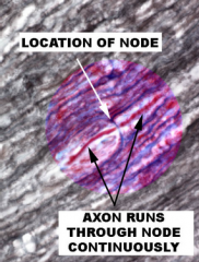 Longitudinal view of nerve, with two internodal segments shown with a node of Ranvier between them.
