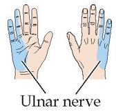 Motor: Finger adduction and abduction other than thumb; thumb adduction; flexion of digits 4 and 5; wrist flexion and adduction